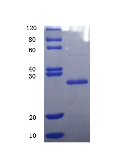 12% SDS-PAGE analysis 12% SDS-PAGE analysis