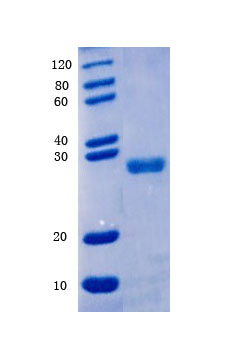 12% SDS-PAGE analysis
