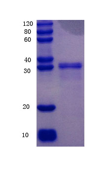 12% SDS-PAGE analysis 12% SDS-PAGE analysis