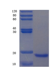 12% SDS-PAGE analysis