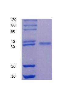 12% SDS-PAGE analysis