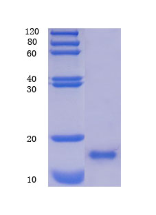 12% SDS-PAGE analysis