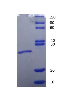 12% SDS-PAGE analysis 12% SDS-PAGE analysis