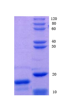 12% SDS-PAGE analysis 12% SDS-PAGE analysis