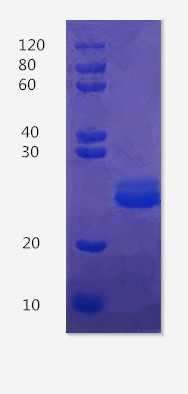 12% SDS-PAGE analysis