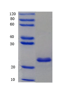 12% SDS-PAGE analysis