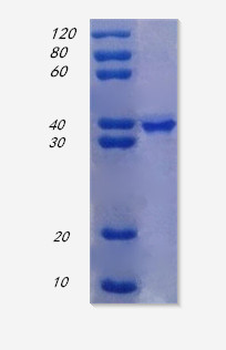 12% SDS-PAGE analysis