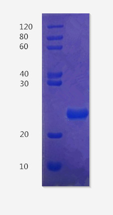 12% SDS-PAGE analysis