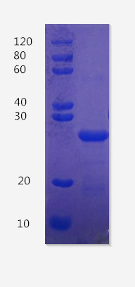 12% SDS-PAGE analysis