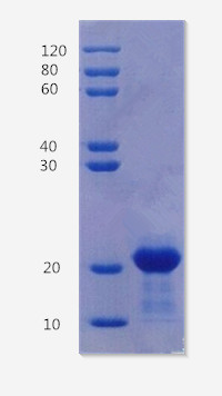  12% SDS-PAGE analysis