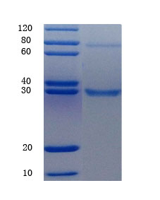  12% SDS-PAGE analysis