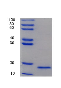 12% SDS-PAGE analysis