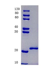 12% SDS-PAGE analysis