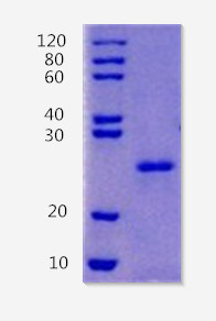 12% SDS-PAGE analysis