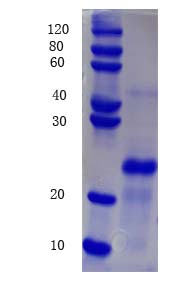 12% SDS-PAGE analysis