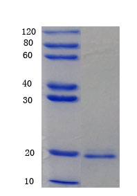 12% SDS-PAGE analysis