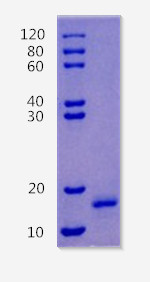 12% SDS-PAGE analysis