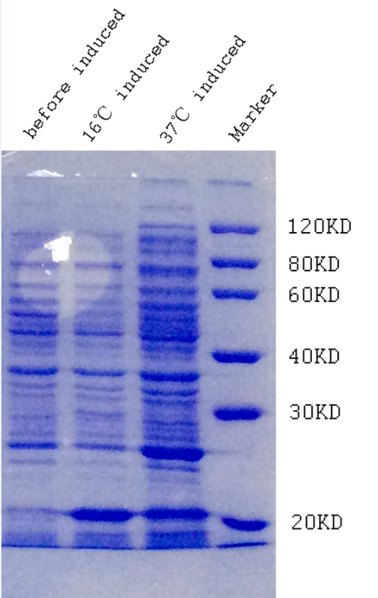 IPTG induced Asprosin protein expression